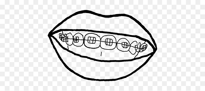 #brackets #sonrisa #dibujo #blancoynegro - Sketch, HD Png Download - sonrisa png