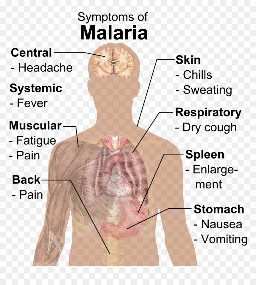 Symptoms Of Malaria - Parts Of The Body Affected By Malaria, HD Png Download - hurt png