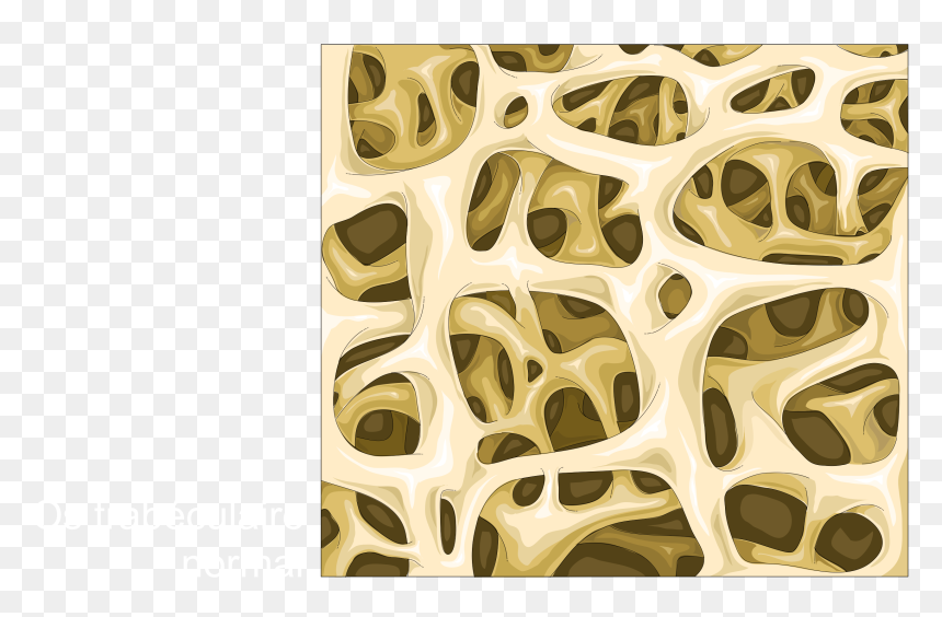 File - Spongy Bone - Trabecular Bone - Normal Trabecular - Spongy Bone, HD Png Download - bone.png