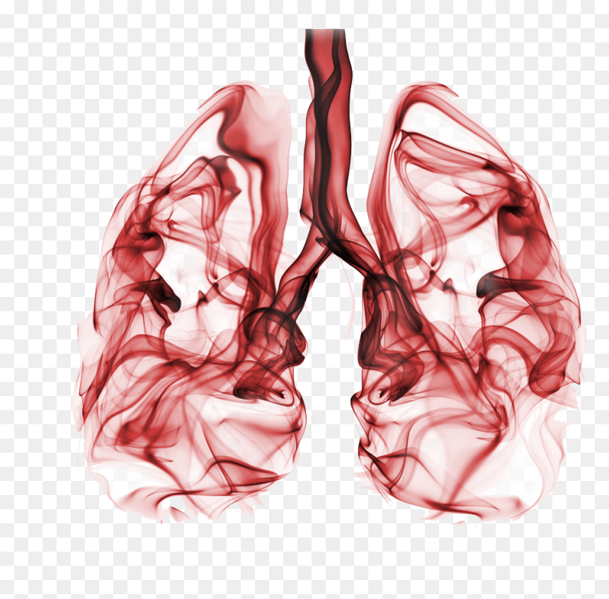 It Is Estimated That Around 80% Of All Lung Cancer - Lung Cancer, HD Png Download - lung cancer ribbon png