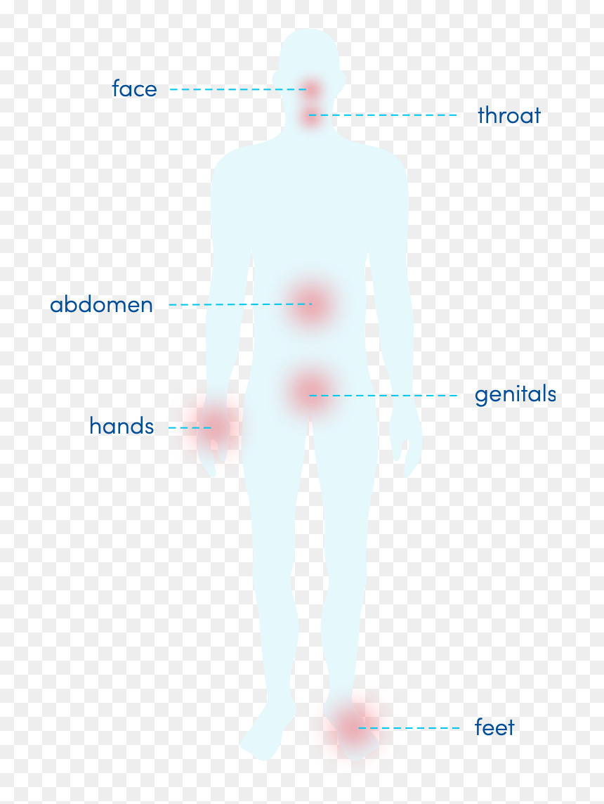 Angioedema On Parts Of Body, HD Png Download - person standing png back