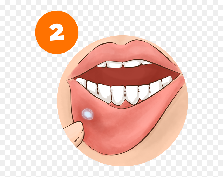 Daktarin Oral Gel Uses, HD Png Download - long tongue png