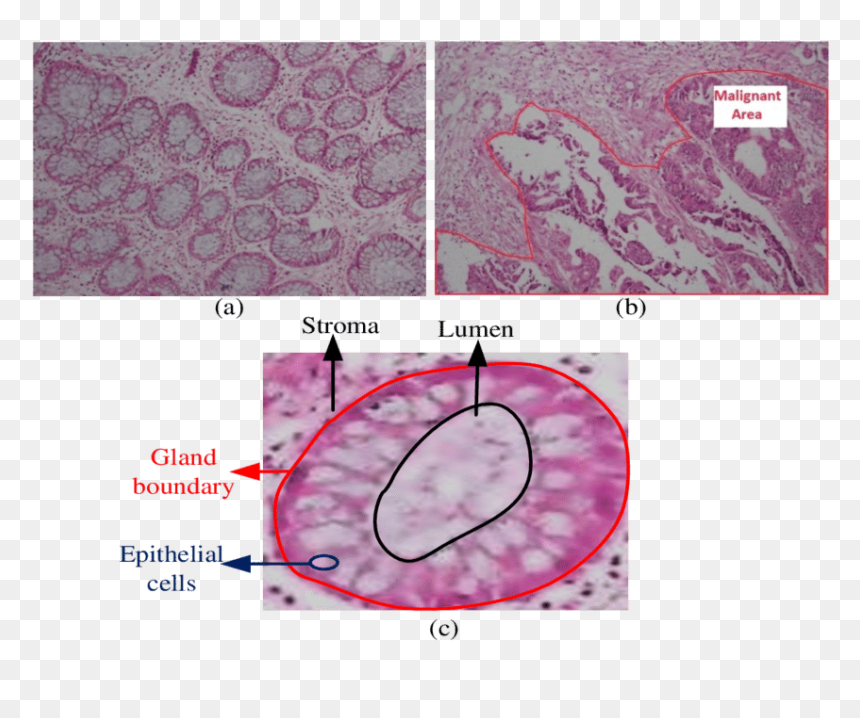 Structure Of Colon Tissue, HD Png Download - colon png