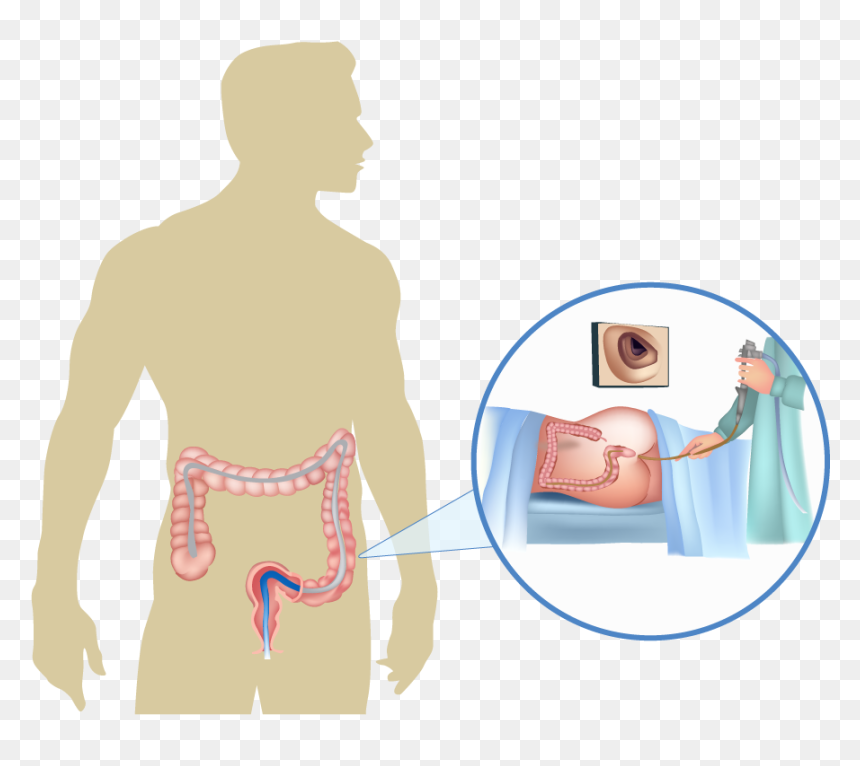 Colonoscopy - Gun Sights, HD Png Download - colon png