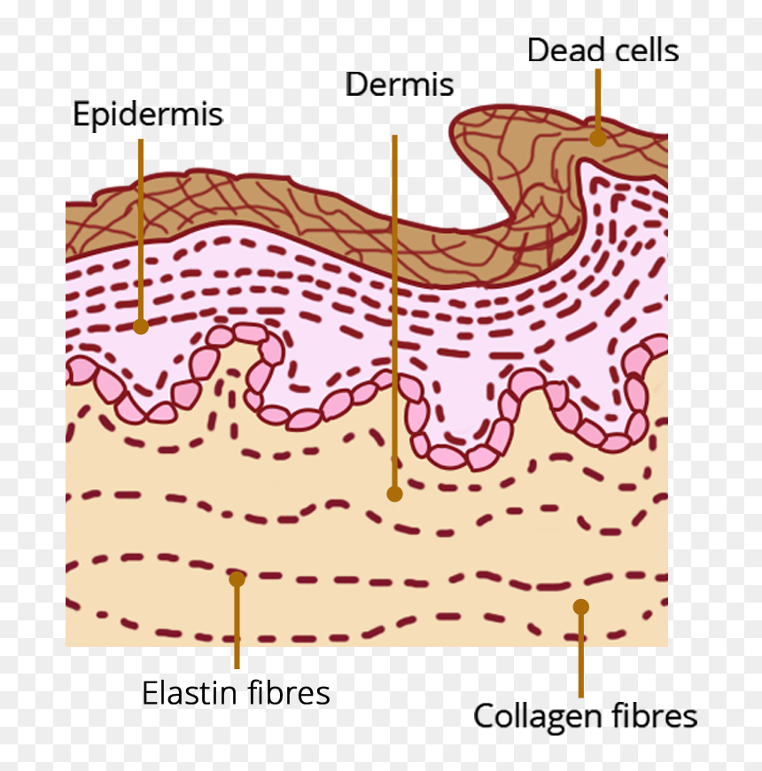 Diagram , Png Download - Before And After Using Hirudoid Cream, Transparent Png - bruises png