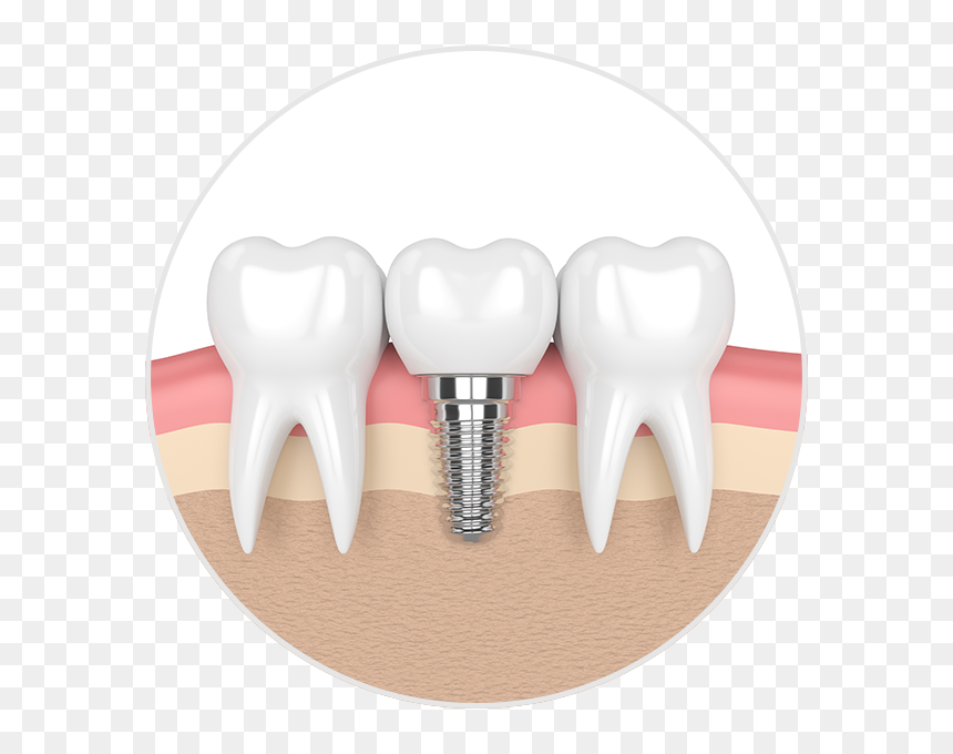 Texas Capitol, HD Png Download - wolf teeth png