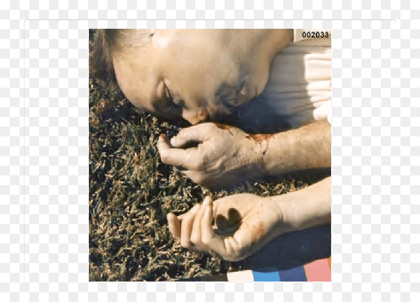 Gesture, Hd Png Download - James Sabow, Transparent Png - bloody hands png