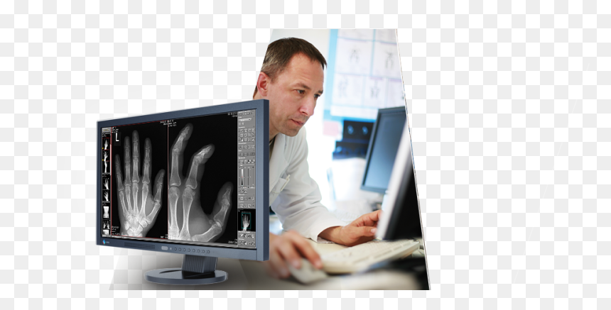 Dicompacs Basis Hman 1b - Output Device, HD Png Download - xray png