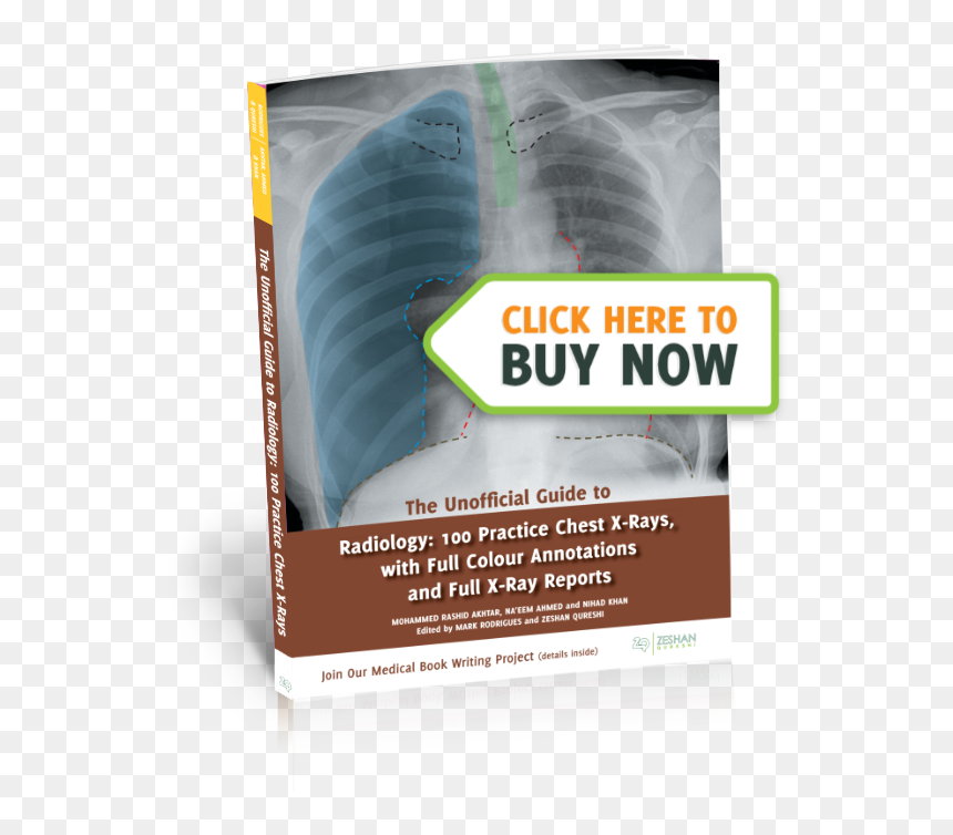 The Unofficial Guide To - Medical Radiography, HD Png Download - xray png
