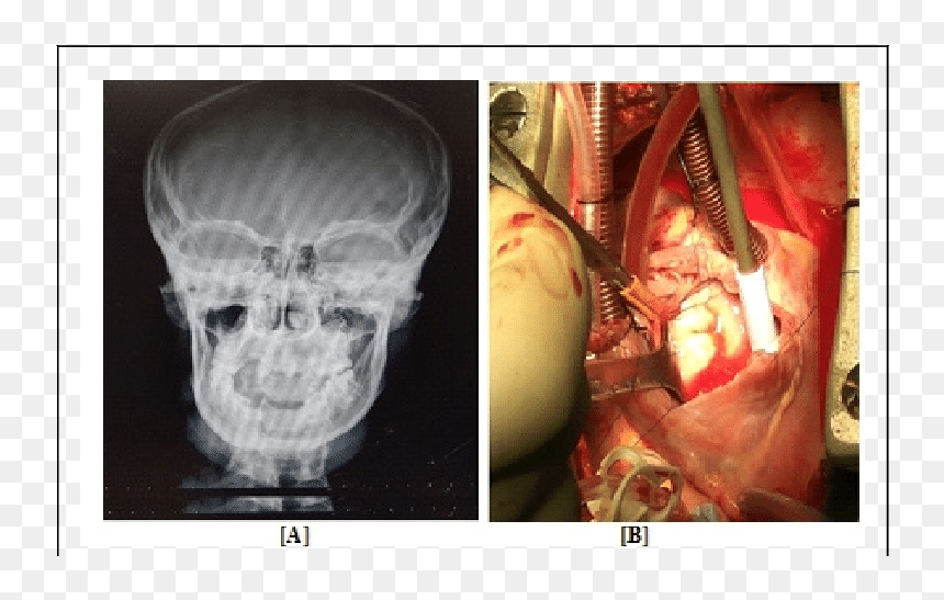 Radiography, HD Png Download - xray png