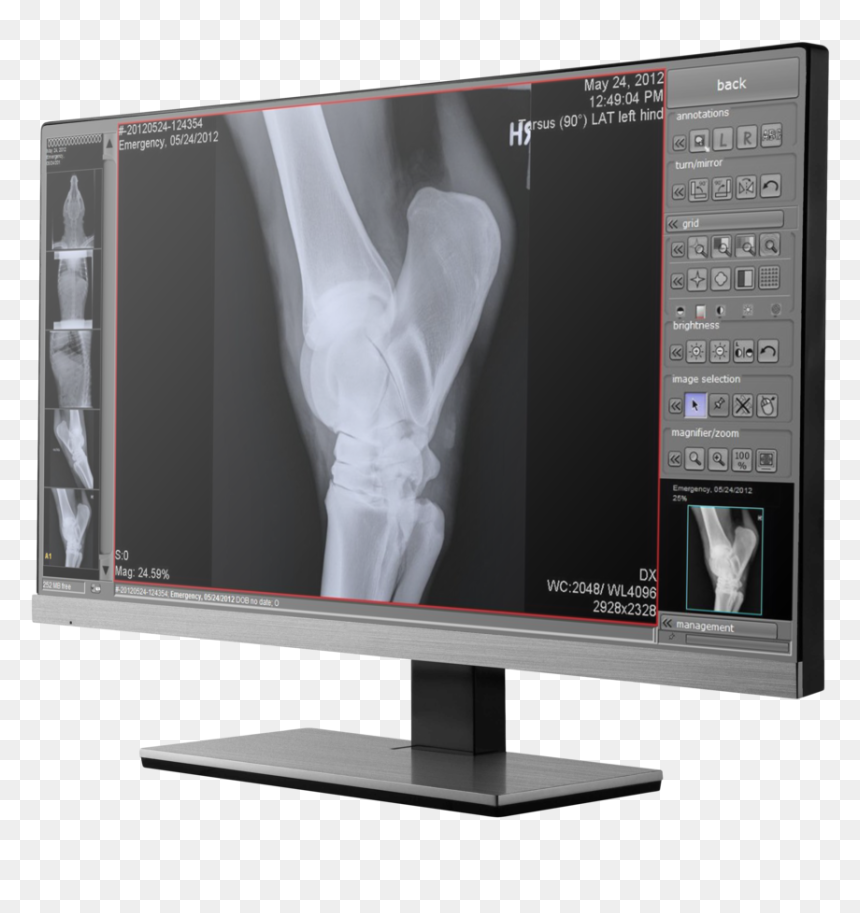 Veterinary X Ray Software, HD Png Download - xray png