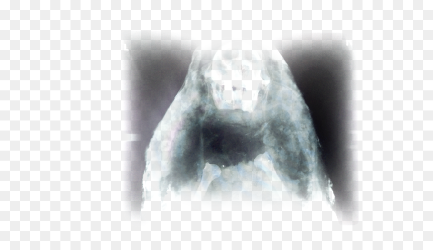 Bones - Radiography, HD Png Download - evil skull and crossbones png