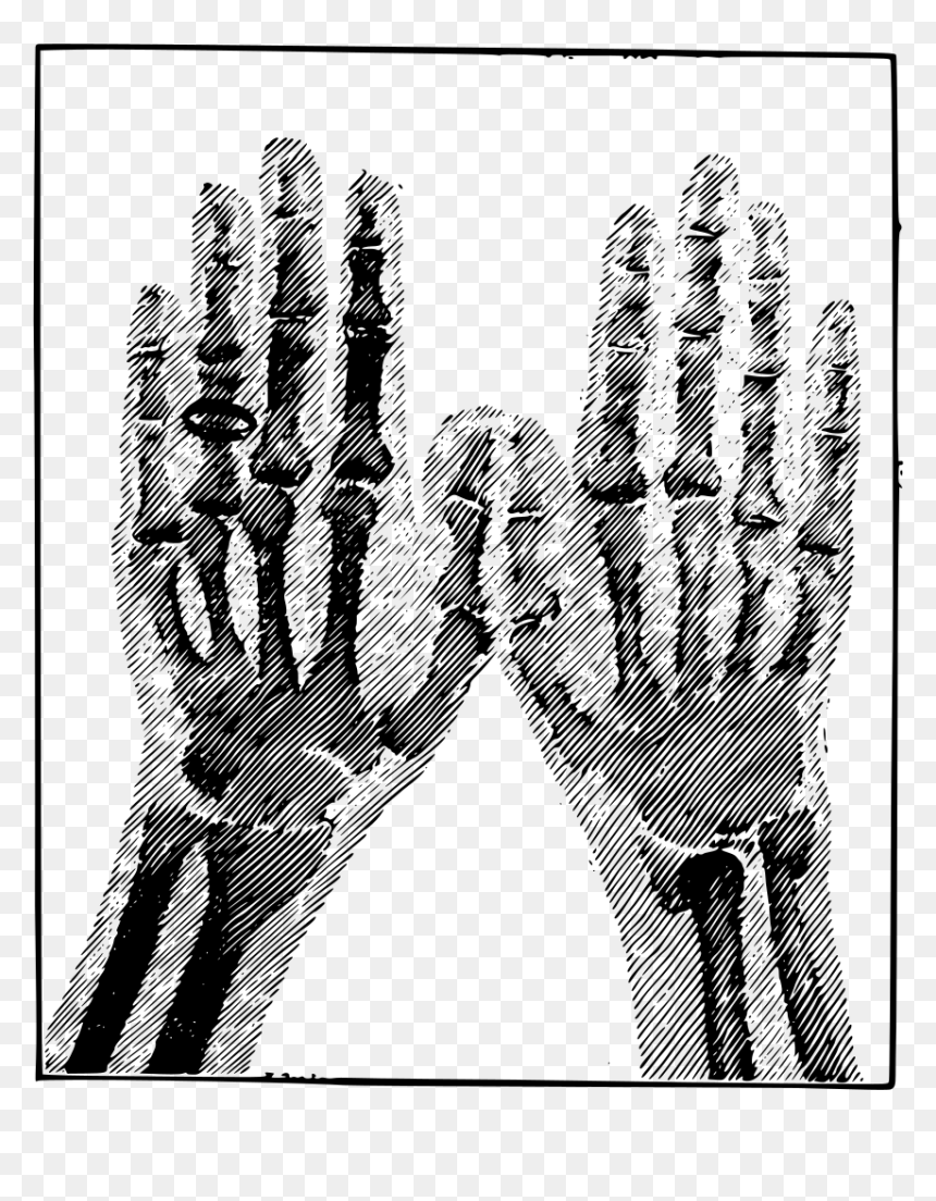 Portable Network Graphics, HD Png Download - skeleton hands png