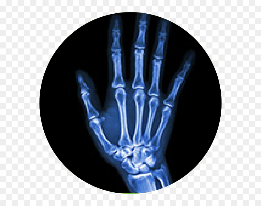Joint Pain, HD Png Download - flat hand png