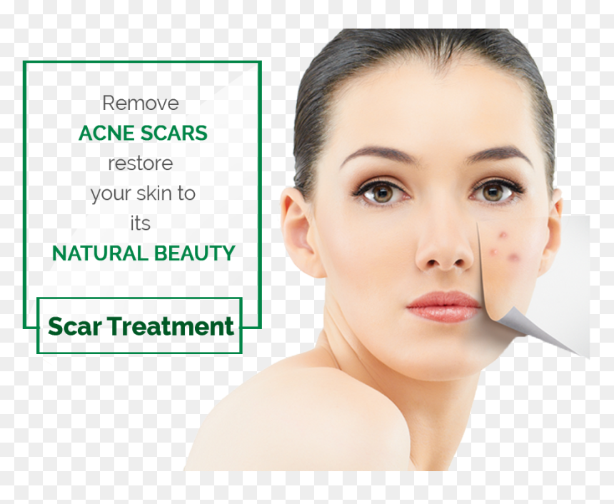 Mole Remover Pen, HD Png Download - scar texture png