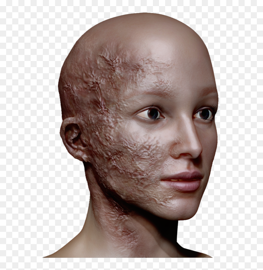 Human, HD Png Download - face scar png