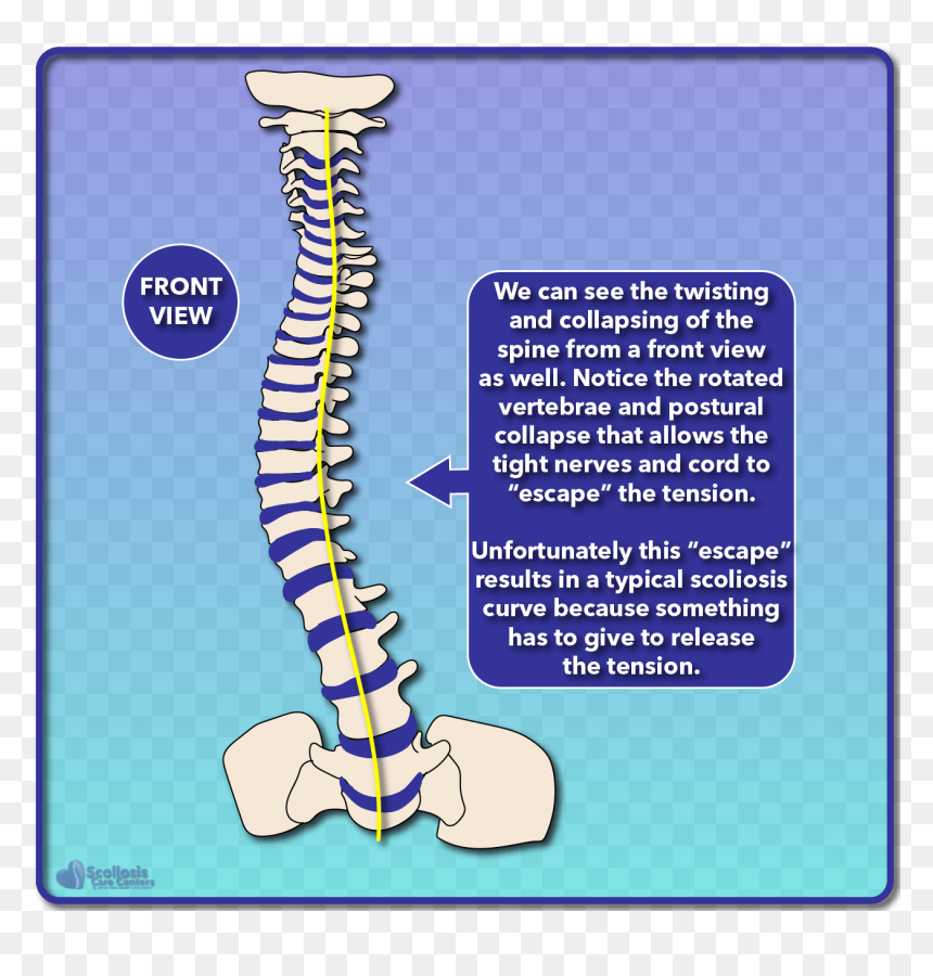 Scoliosis Effects On Nervous System, HD Png Download - nerves png