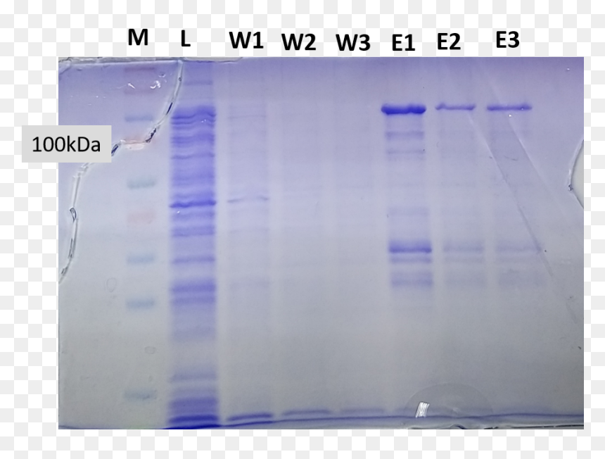 Document, HD Png Download - ice cicles png
