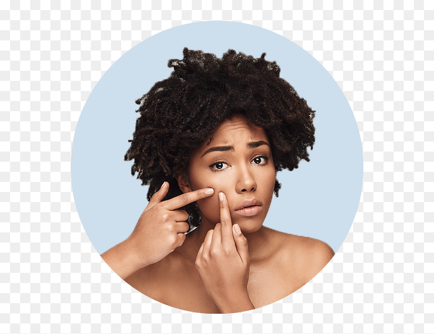 Scar - African American Blackhead Removal, HD Png Download - face scar png
