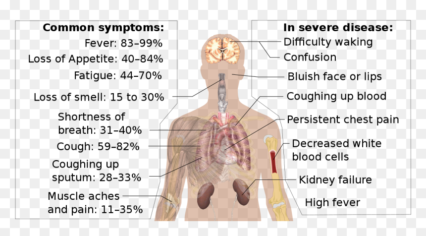 Coronavirus, HD Png Download - coughing png