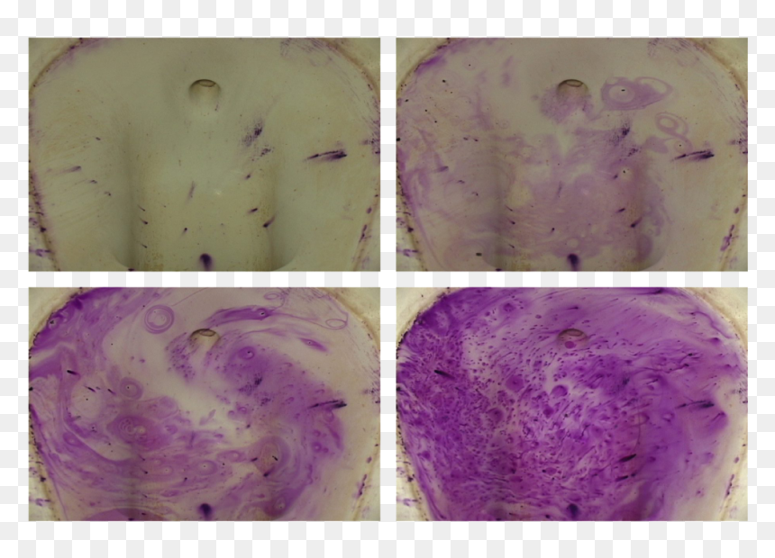 Plant Pathology, HD Png Download - pipa png