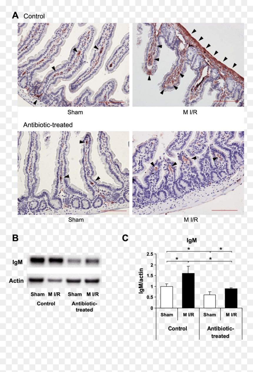 Igm Intestine, HD Png Download - small intestine png