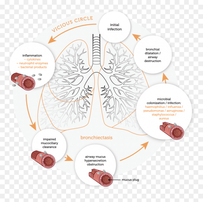 Diagram, HD Png Download - coughing png