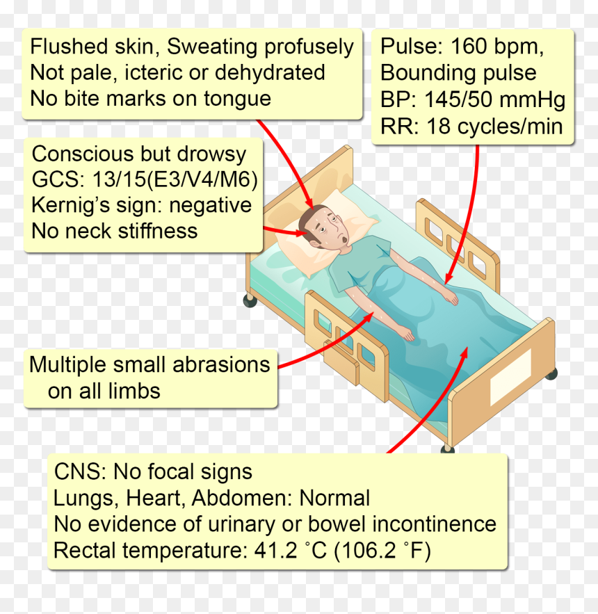Diagram, HD Png Download - bite marks png