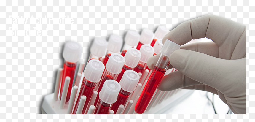 Keep Fat Related Health Problems In Check - Blood Test Tubes Png, Transparent Png - blood test png