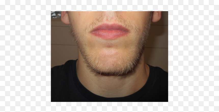 Selfie, HD Png Download - blonde beard png