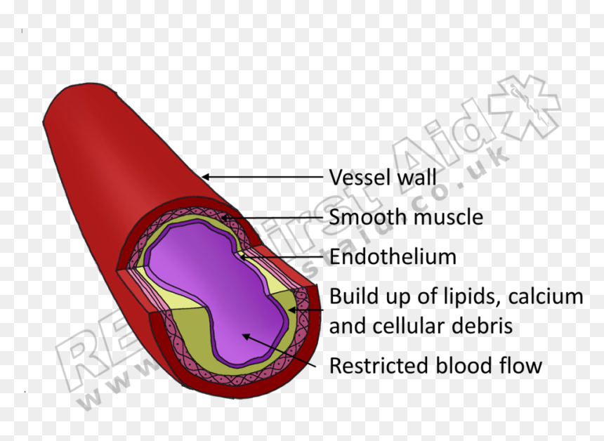 A Healthy Blood Vessel - Lilac, HD Png Download - restricted png