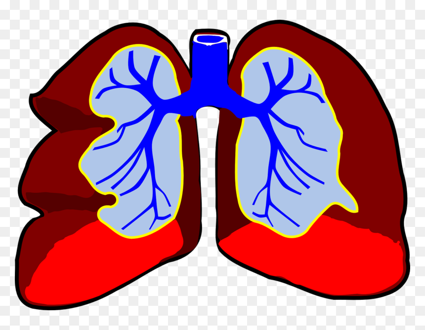 Lungs Clip Art, HD Png Download - infection png