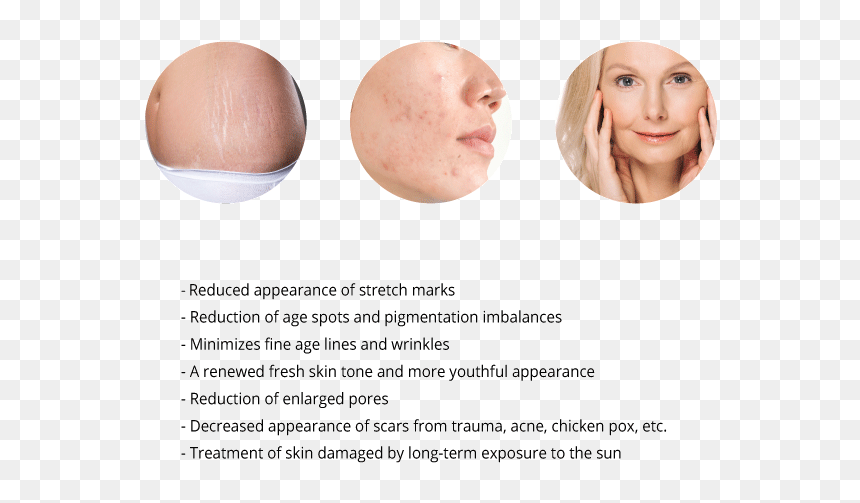 Blond, HD Png Download - face scar png