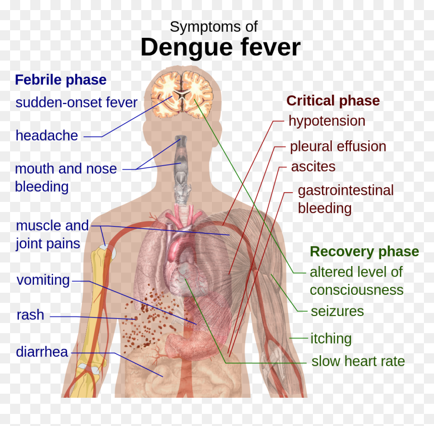 Dengue Fever Symptoms In Tamil, HD Png Download - joint .png