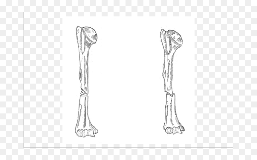 Sketch, HD Png Download - peg leg png