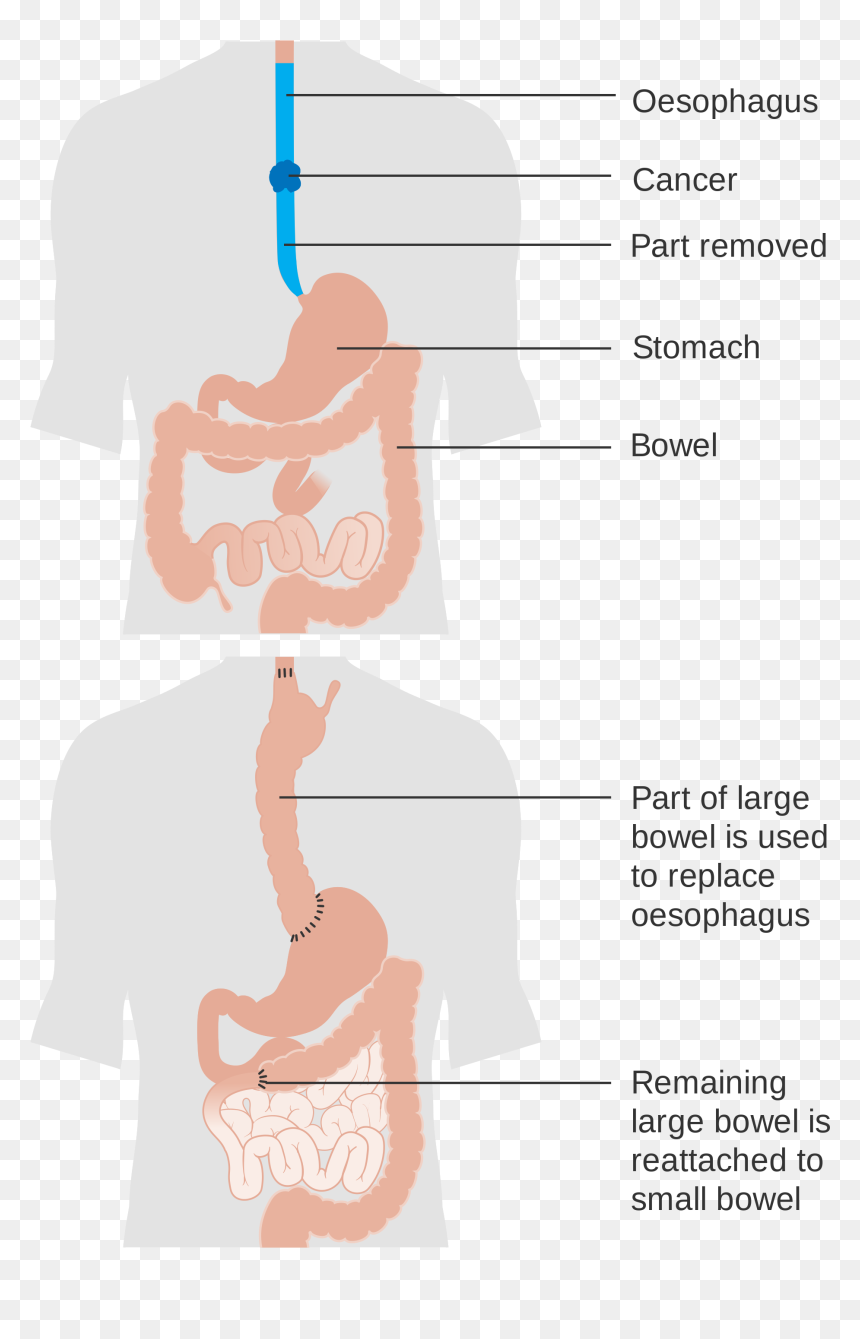 Illustration, HD Png Download - esophagus png