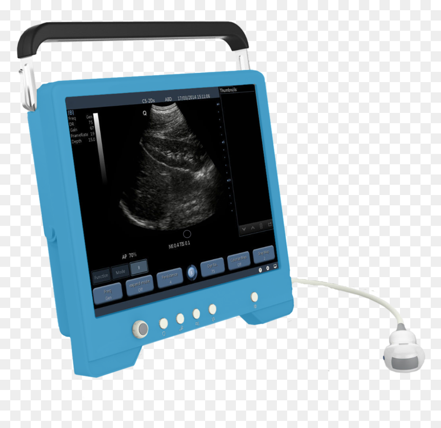 Ultrasound Touchscreen, HD Png Download - 2ds png